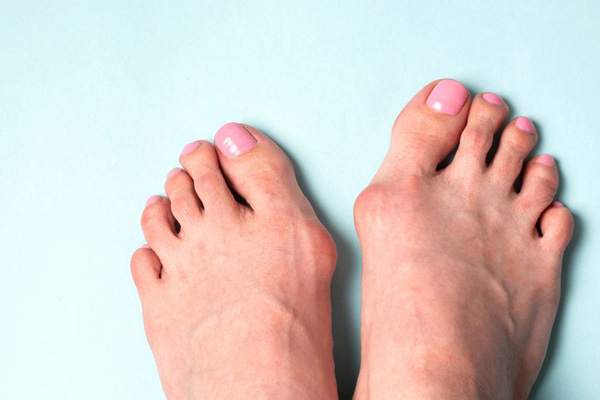 dott michele saporito ortopedico